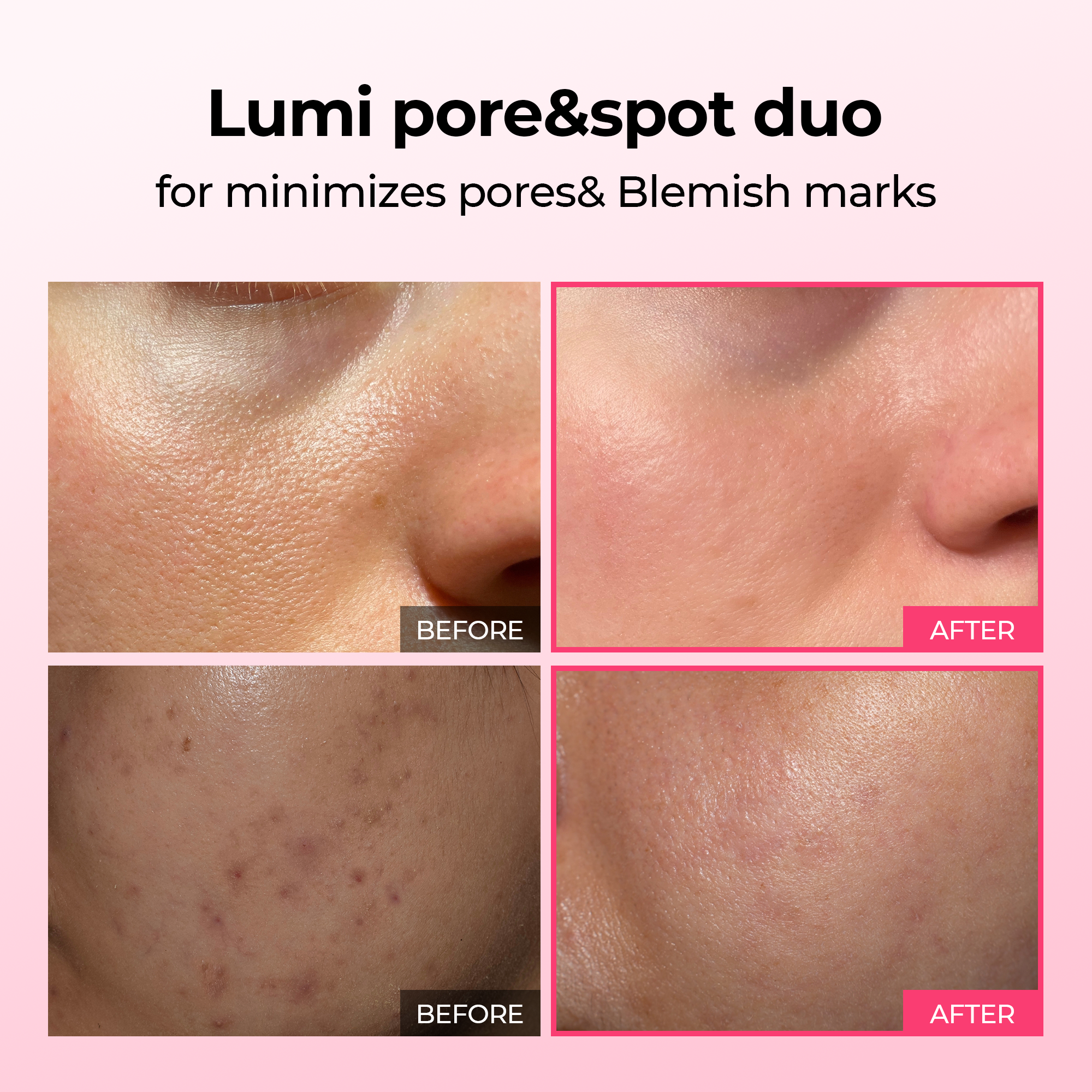 Alternative view of Lumi Pore & Spot Care Duo